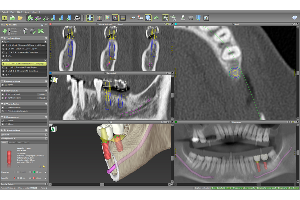 歯科用CTを導入した精度の高い診断